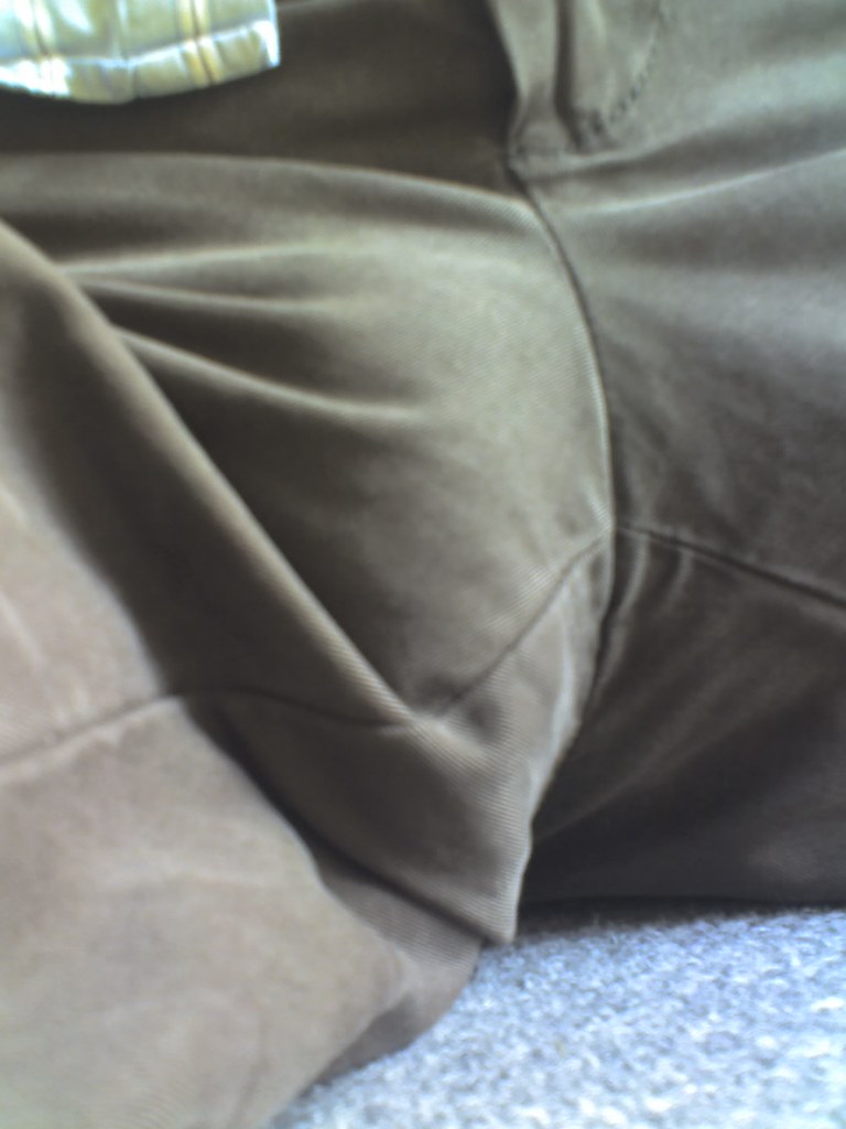 The Enigmatic Protrusion: Deciphering the Mysteries of Bulge